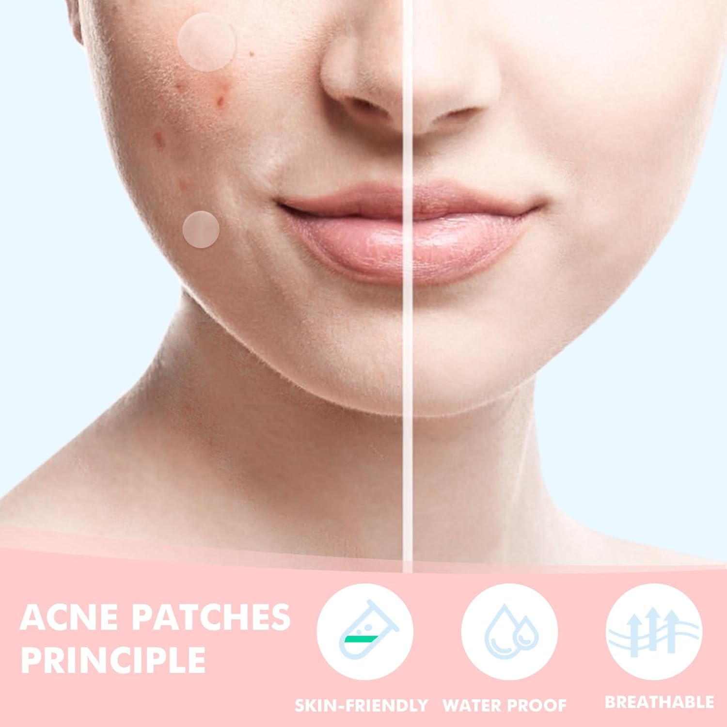 1724367053 555 Pimple Patches for Face 304pcsHydrocolloid Acne Patches StarZit PatchesPimple Popper